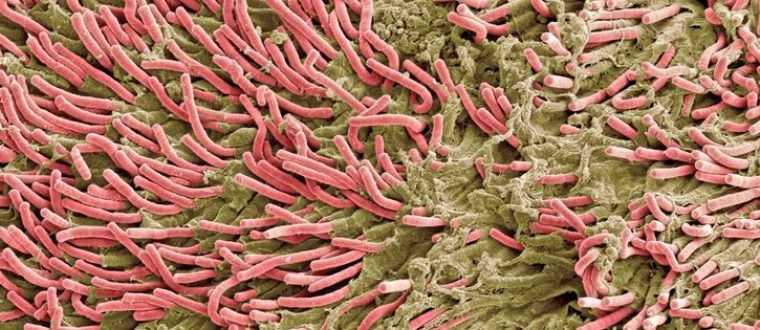 ביופילם – קרומים של חיידקים